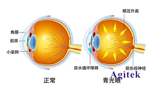 TH2851系列高精密阻抗分析仪在新型眼科中的应用(图1)